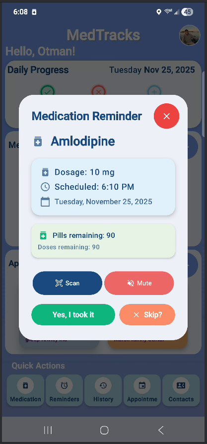 Medication reminder alert with take and skip actions